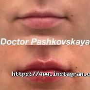Face Zone, клініка естетичної медицини фото