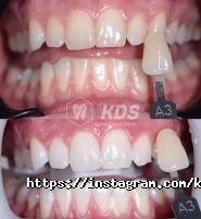 Kalita Dental Studio, стоматологічна майстерня фото