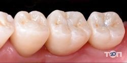 Crystal Dental Studio, стоматологія фото