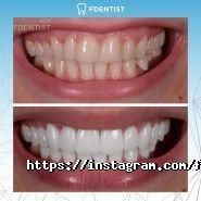 Fdentist, клініка естетичної стоматології фото