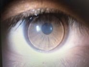 Центр коррекции зрения фото