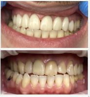 Dr.Datsiuk, стоматологія фото
