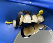 Дентал Пленет, стоматологія фото