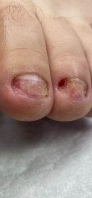 Подолог Живець Ольга фото