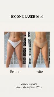 SiluetStudiya, студія масажу фото