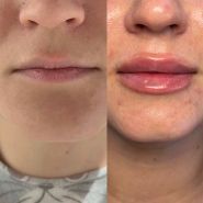 Студія перманентного макіяжу Катерини Паламарчук фото