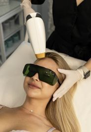 BlueFox, лазерна епбіляція фото