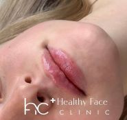 Healthy Face Clinic, клініка здорової краси фото