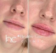 Healthy Face Clinic, клініка здорової краси фото