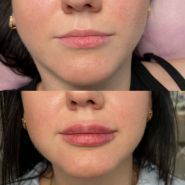 Студія перманентного макіяжу Катерини Паламарчук фото