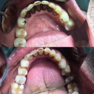 Дентал Пленет, стоматологія фото