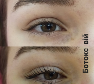 Косметолог Бессараб Марианна фото