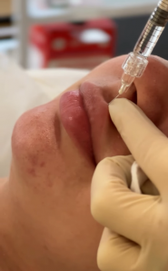 Косметолог Алина Найчук фото