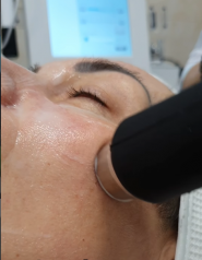 LC, центр лазерної косметології фото