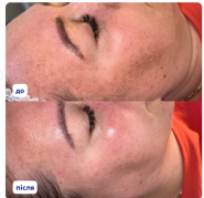 LaserStudio, лазерная эпиляция фото