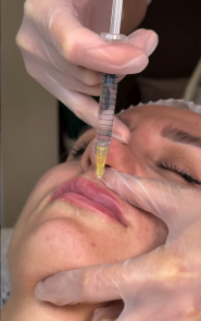 Люменис, центр лазерной эпиляции фото