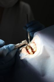 Alma Dent, стоматологія фото