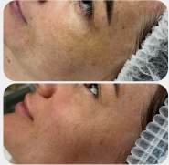 Skin Beautique, косметологічні послуги фото