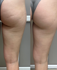 Студія масажу Олександра Литвина фото