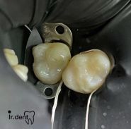 Ir.Dent, стоматология фото
