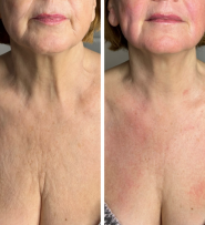 Ольга Мінакова, студія масажу фото