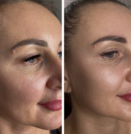 Ольга Мінакова, студія масажу фото