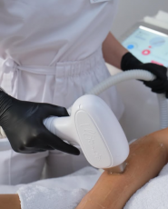 Marmelad Lazer, лазерна епіляція фото