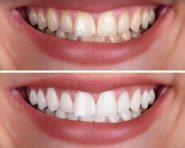 Стоматологія на Татарській фото