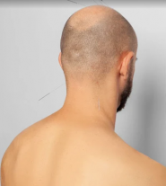 WEI LONG, центр цигун-терапії фото