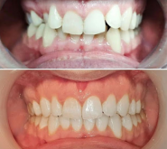 Стоматологія на Татарській фото