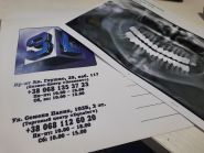 3Діагностика, панорамні знімки та комп'ютерна томогрфія фото