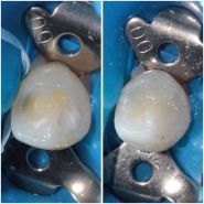 VA Clinic, стоматологія фото