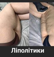 Академія регенерації краси dr.Башняк фото