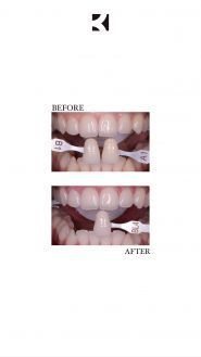 К3 Dental Dіgital Clinic, стоматологія фото