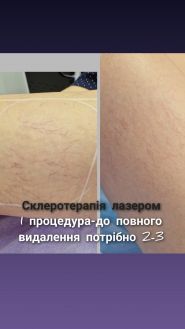 Косметология на Звездном б бульваре фото