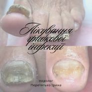 Foot Control, центр нігтьової естетики та подології фото