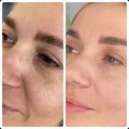 Beautymed Clinic, центр естетичної краси та здоров'я фото