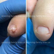 Podolog Family, врач подолог фото