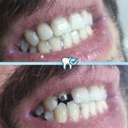 Brilliant Smile, стоматологія фото