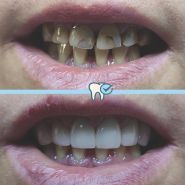 Brilliant Smile, стоматологія фото