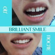 Brilliant Smile, стоматологія фото