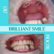 Brilliant Smile, стоматологія фото