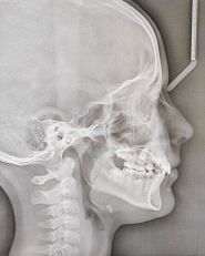 Supreme, стоматологічна клініка фото