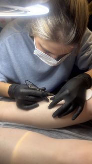 Impulse, лазерна епіляція фото