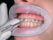 Дент студія, стоматологічна клініка фото