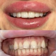 Dental Luxury Clinics, стоматологическая клиника фото