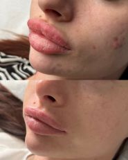 Dr.Volkova Ekaterina, косметолог фото