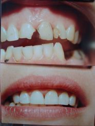 Мірздрав, стоматологія фото