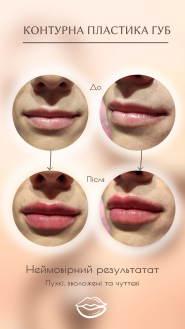 Ляшевська Анна, косметолог фото