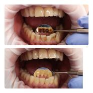 NKDent, стоматологія фото